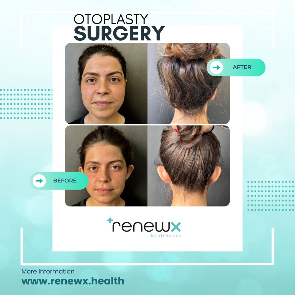 Before and After Result